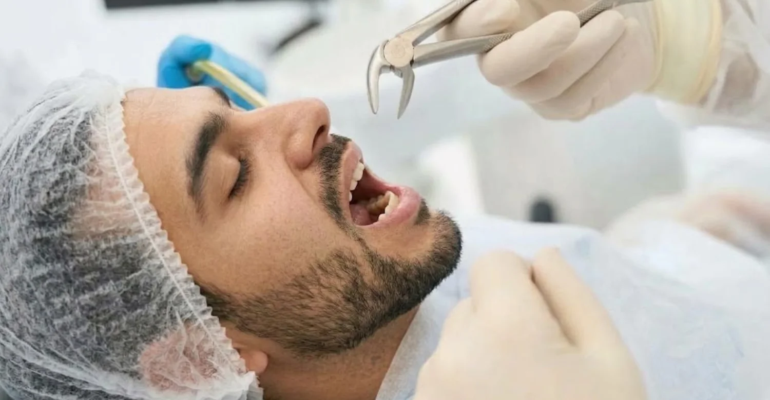 Antiplatelet Therapy and Dental Extraction inblog